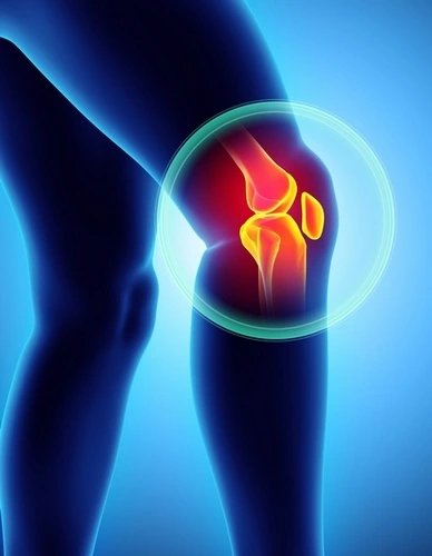 Prise en charge de l'arthrose par prothèse totale de genou Prise en charge de l'arthrose par prothèse totale de genou